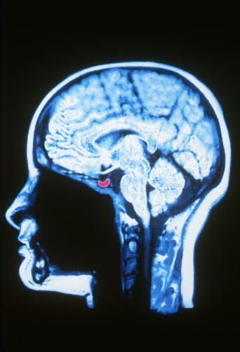 forallcurious's tweet photo. A teenager in France can mentally time travel ─ one of fewer than 100 people on Earth!

She can mentally travel back to any day of her life, reliving past events with rich sensory detail, and can similarly project herself into the future using the same brain processes. https://t.co/yMwvTQ9FkS