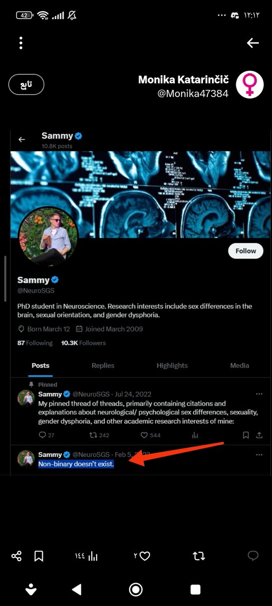 Sunday_Ahmed666's tweet photo. @CircusSSCaine This day is unreal and doesn't exist because there is no such thing as "I don't have a gender." There is no such thing as "I am neither male nor female." The pronoun "they" is unreal and doesn't exist.

Also, your birth certificate will state "male" or "female." https://t.co/TpnYuqVSiT