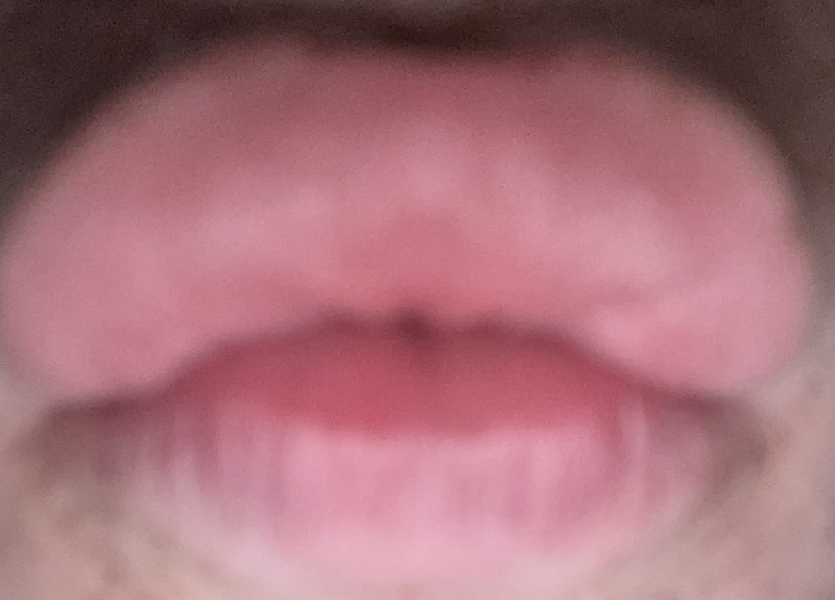 carterthadoll's tweet photo. Just bc I say the n word and Im white that don’t mean im racist

I suck niggers cocks with these big white beautiful femboy lips all the time https://t.co/EiPtP2bNw4