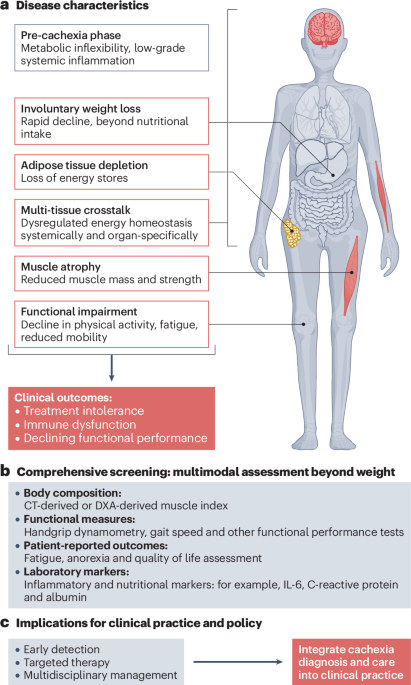 NatureRevEndo's tweet photo. New content online: Reframing cancer cachexia: from malnutrition to treatable disease https://t.co/oQ079x2jc2 https://t.co/bEKDihPtDT