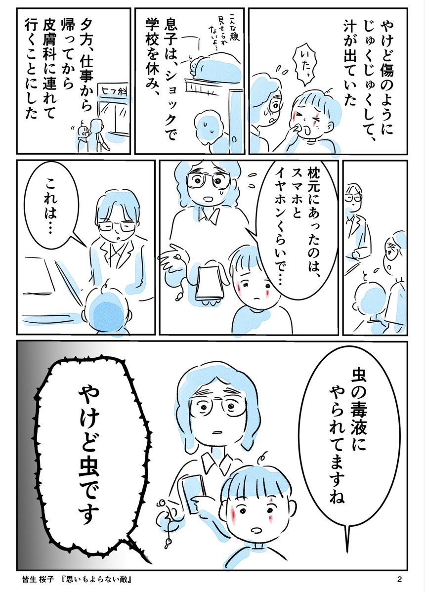 KaikeSakurako's tweet photo. 【朝起きたら、顔にやけど？】その2
#やけど虫 
#アオバアリガタハネカクシ https://t.co/XRqXMVUGzs