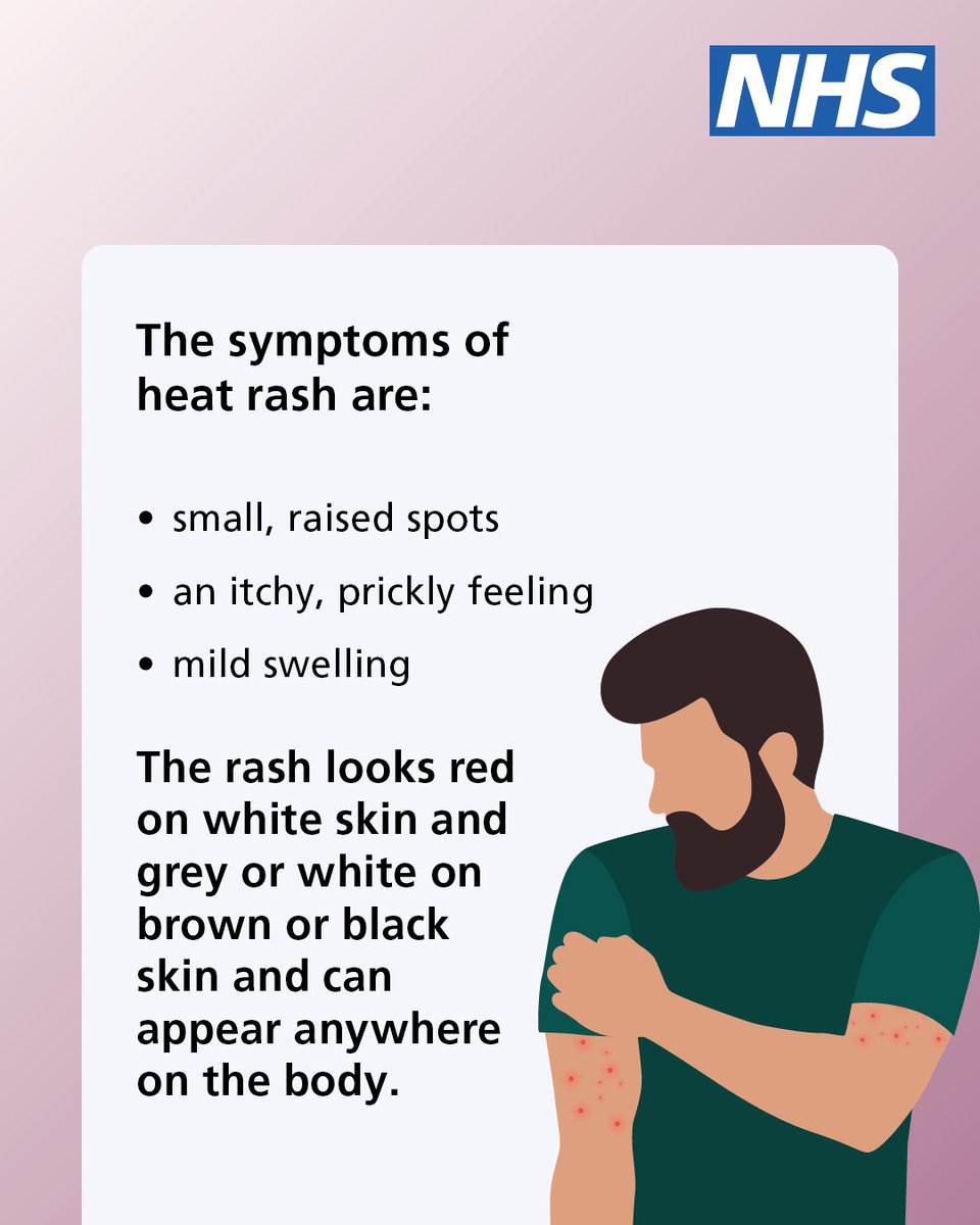 NHSuk's tweet photo. Heat rash is common during hot weather.

It is uncomfortable, but usually harmless. It tends to get better on its own after a few days.

Here are some tips to help you check if you have heat rash – and advice on how to treat it ⬇️