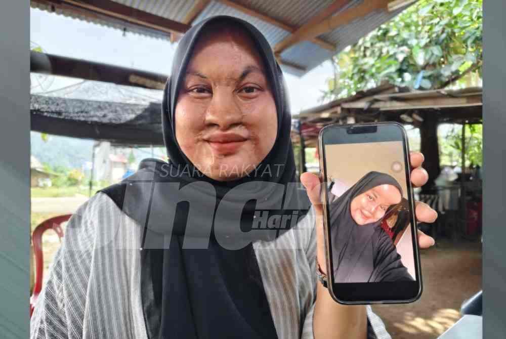 SinarOnline's tweet photo. 'Disimbah cuka getah oleh bapa sendiri' - 16 tahun tragedi hitam berlalu, derita masih belum berakhir

Peristiwa pada awal pagi 15 Ogos 2010 itu bukan sahaja meninggalkan parut kekal, malah hospital seolah-olah ‘rumah kedua’ sehingga kini.

BACA: https://t.co/E92F8kCXj0

#sinarharian #beritaterkini #cukagetah #asid