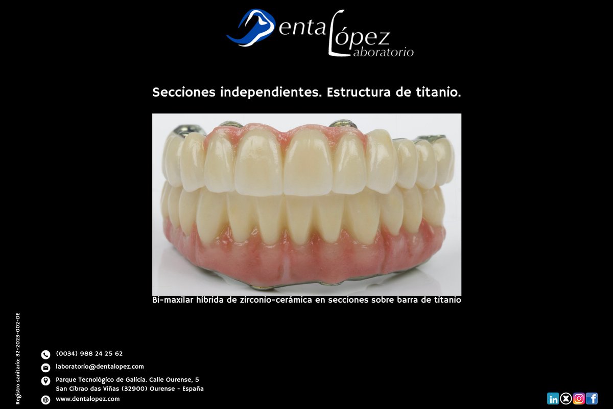 DentaLopez's tweet photo. Una rehabilitación bi-maxilar híbrida de zirconio-cerámica en secciones sobre barra de titanio.

En prótesis sobre implantes, la forma de resolver el caso importa.

#ProtesisDental #Implantologia https://t.co/yKZ6coxb2Q