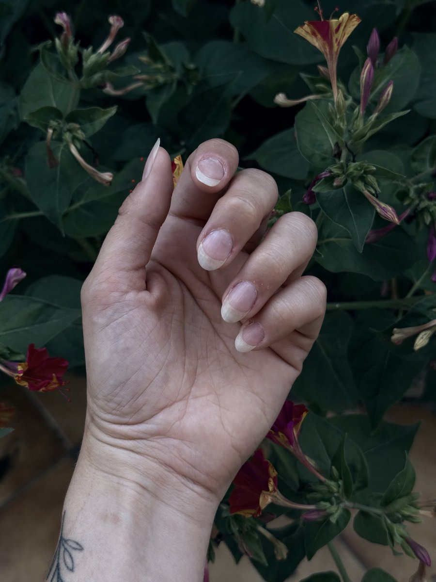 jiduckari's tweet photo. Le 15 juillet 2025, je m’étais fixée un objectif de ne plus me ronger les ongles.. je peux vous annoncer que j’ai réussi un nouvel objectif, je suis enfin sortie du clan des ongles rongés 👀🥰 https://t.co/2je1F8An25