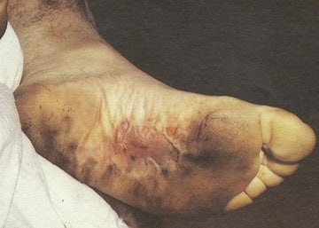 outsidersesp's tweet photo. Los policías que torturaron hasta la muerte a Joxe Arregi nunca fueron apartados de sus cargos.

De los 70 policías que lo torturaron, sólo dos fueron condenados. El gobierno de Felipe González los indultó. Luego fueron ascendidos.

La "democracia" en España premia la tortura. https://t.co/l1XkBUE7dC