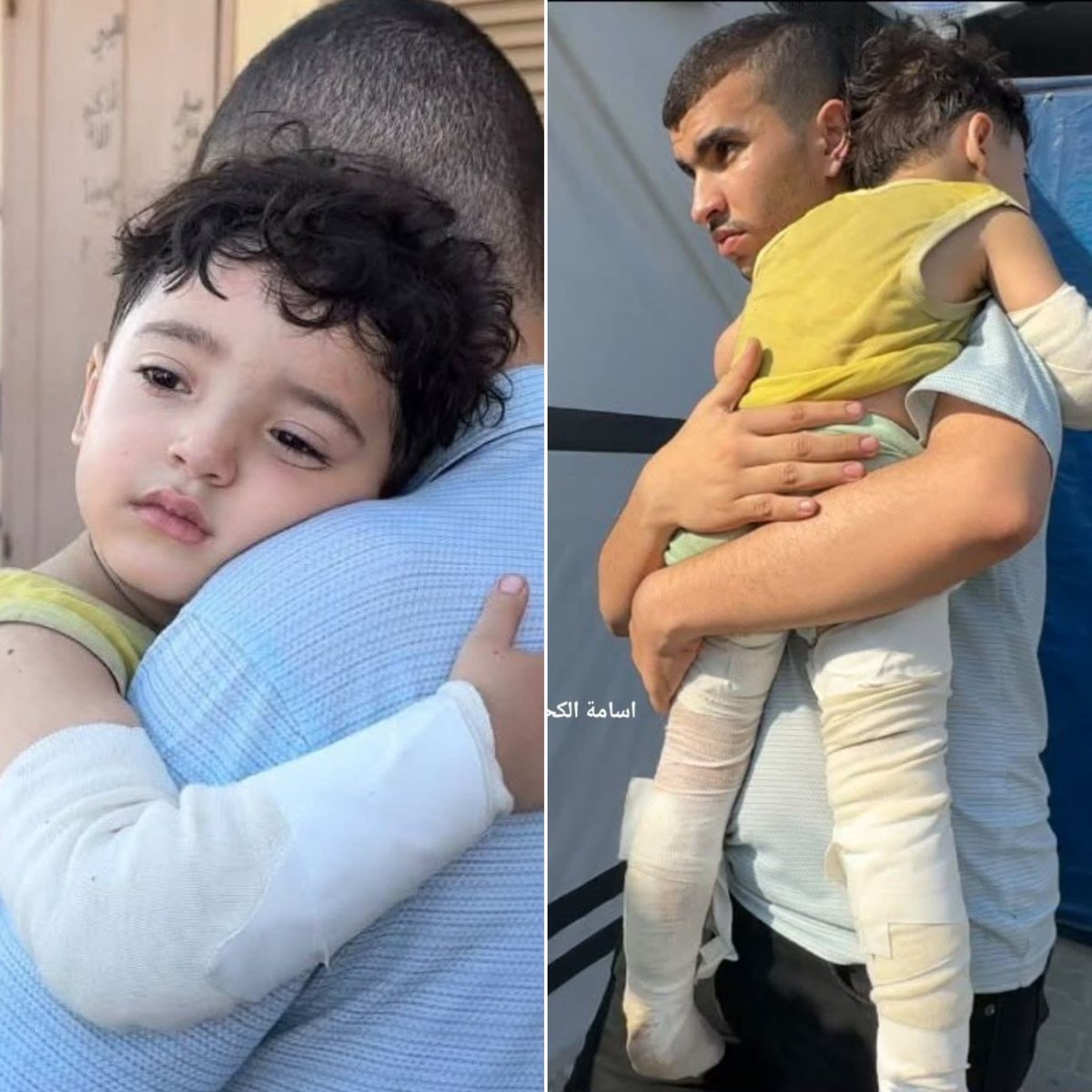 saeedziad's tweet photo. سامي ابو قاسم الناجي الوحيد ..
قصفته إسرائيل ليلة أمس، فقلت جميع أفراد أسرته.
نام في حضن والدته واستفاق على رحيل اسرته بأكلمها. https://t.co/7QTx63rf7V