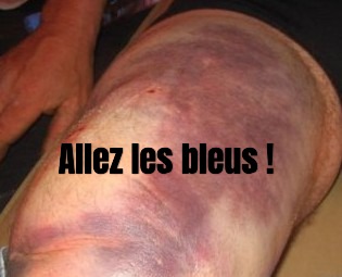 siorac34's tweet photo. @afpfr https://t.co/npCxX2GWVQ