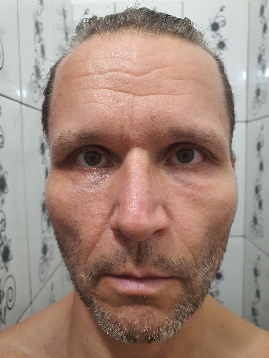 SalomonRejuven's tweet photo. ๐ฅ I found the fountain of youth of the emperors.
Day 4588 Age 53 โ reversing into low 40s.
No filters. No shortcuts. Just biology reactivated.
Goal: 25.
I post daily until I get there. Watch closely.
๐ช
#RejuvenationBodybuilding #ReverseAging #Longevity #Shredded https://t.co/DoTE2NDIfg