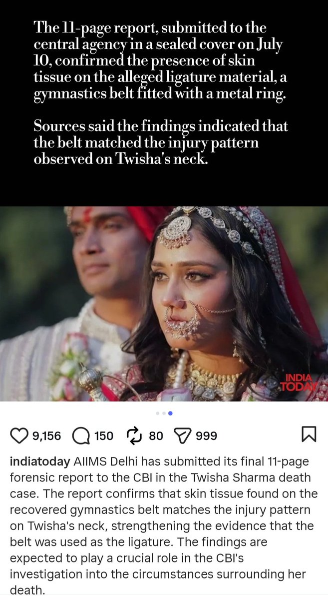 Yasmin2186's tweet photo. In Twisha Case, Delhi AIIMS report confirmed the present of skin tissue on the ligature material.

Why @aiims_nd did not show the same honesty in #SSR case? #SudhirGupta is answerable on whose instructions he changed his statement from 200% murder to 100% suiicde? Who bribéd him? On what basis was he able to reach a conclusion despite destroyed evidence, a 100-day-old viscera report, a shoddy postmortem, and without examining the body? #ShameOnAIIMS & Corrupt Sudhir Gupta. #JusticeForSushantSinghRajput