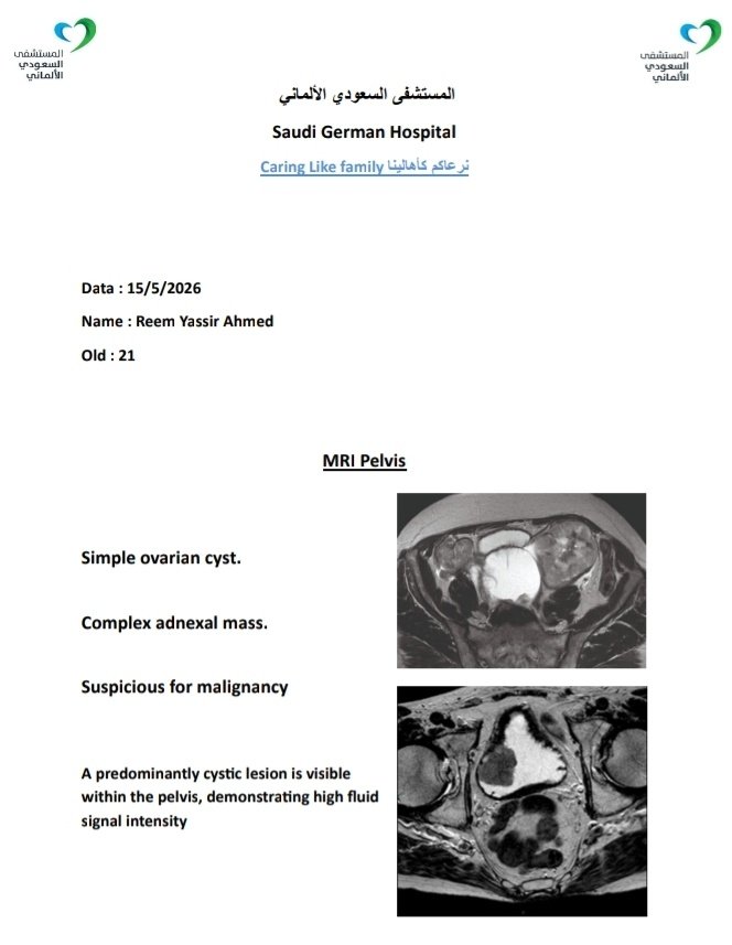 abduallah_amin's tweet photo. [Urgent]
Sister Reem needs our help once again. After her previous surgery, she has now been diagnosed as suspicious for malignancy, meaning that cancer is once again a possibility. She requires chemotherapy sessions and another surgery
Donate &amp; info here:
https://t.co/Nz6xH1PEDQ https://t.co/fQbKAqR8B3