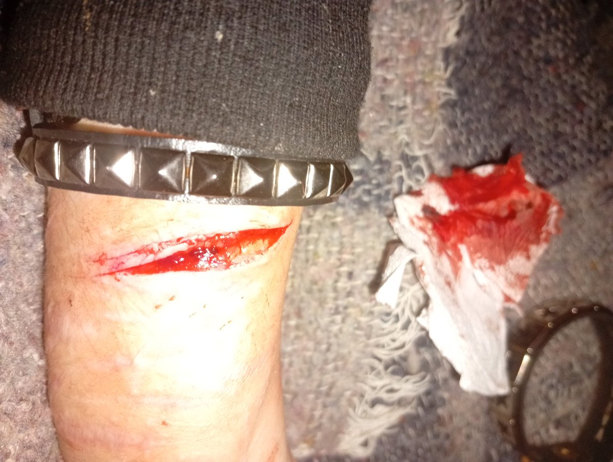 Mick_elnub's tweet photo. Y que se supone que es eso eh? Fuck una arteria o q

(⚠️SANGRE FALSA MAKEUP NO ES REAL⚠️)
#sh #subtwt  #shtなりきりさんがrtしてくれてそれを見たshtなりきりさんがきっとフォローしてくれる https://t.co/yZGp8Gkj8C