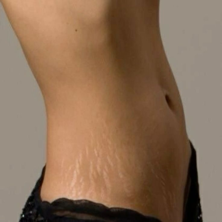 bruisedpeony's tweet photo. · · ─ ·✶· ─ · ·
Unpinning when out of 170's! 
· · ─ ·✶· ─ · · https://t.co/wZAITE75zm