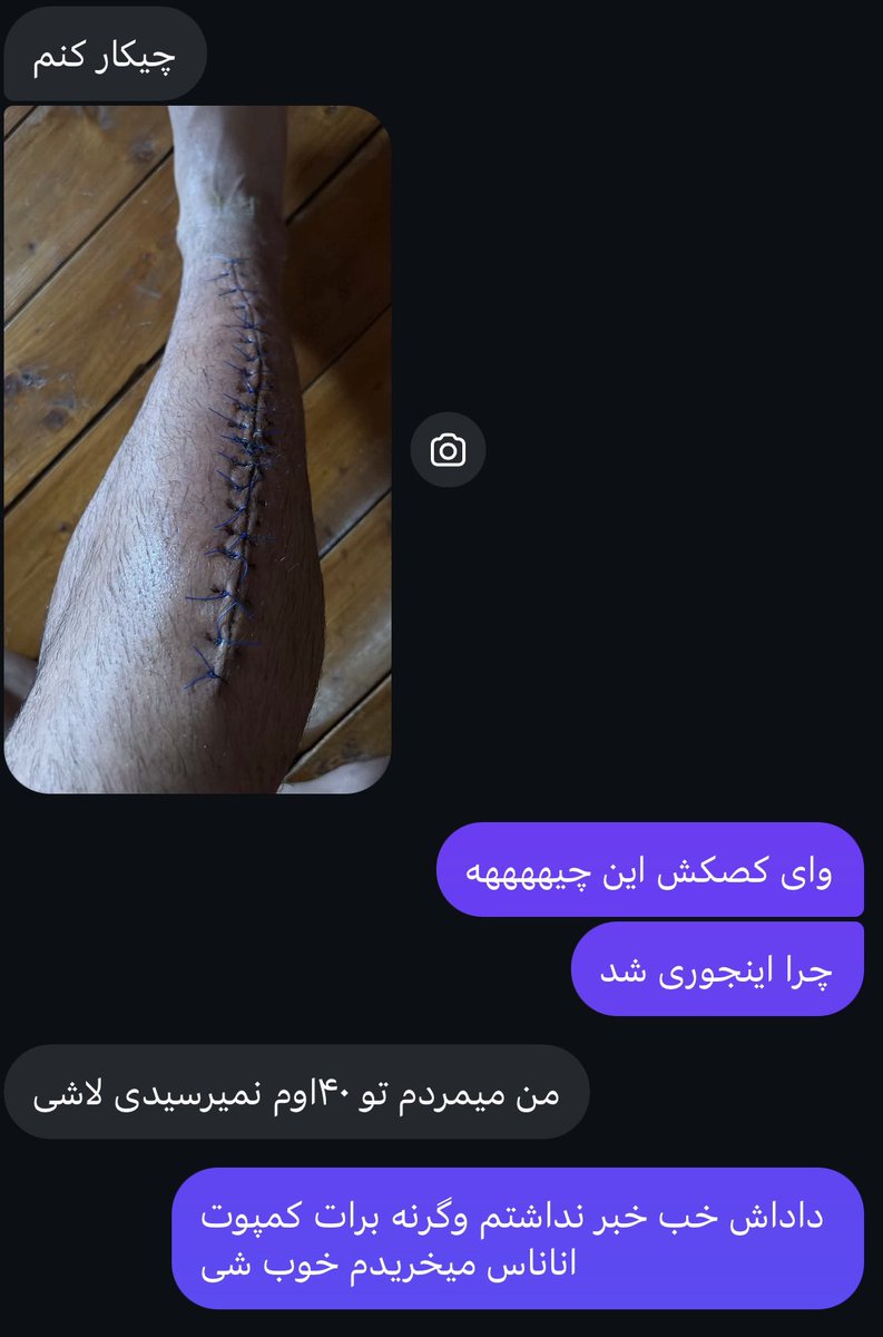 Shasosashere's tweet photo. اون رفیقم که یه ماه به حال خودش رهاش کردم https://t.co/mhk7yPvSbY