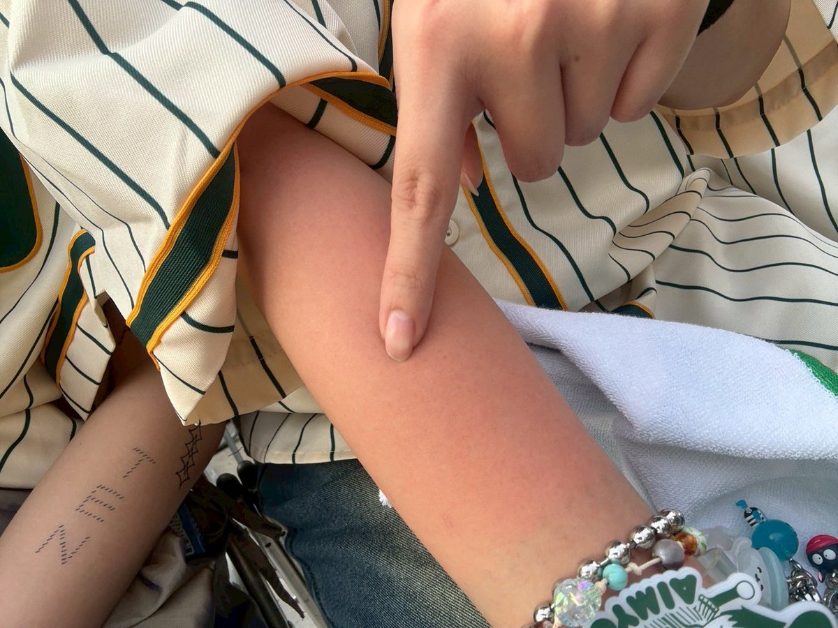 38myon's tweet photo. @aimyonGtter はじめての甲子園球場に連れてってくれてありがとう🏟️📣あと、お陰様でAIMとはじめての連番もできた‼️最高の夏開幕してぶち上がりだYeah⤴️🔥腕真っ赤になったよ𛰙᭜𖫴𖫰𖫱𖫳𖫲𖫲𖫳𖫴𖫰𖫱꛰·̫ ᭜𖫴𖫰𖫱𖫳𖫲𖫲𖫳𖫴𖫰𖫱꛰ಣ https://t.co/bnDR3lG58s