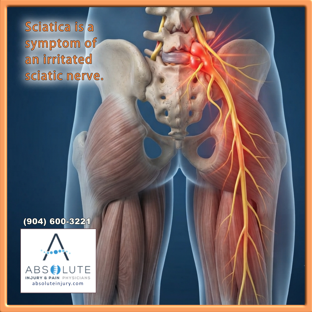 AbsoluteInjury2's tweet photo. Sciatica shouldn't dictate your day. Find natural relief and rediscover your movement with targeted chiropractic care.

Give us a call or come see us—we can help.
https://t.co/RpHyWANC8i https://t.co/rvyh7RN7Yf