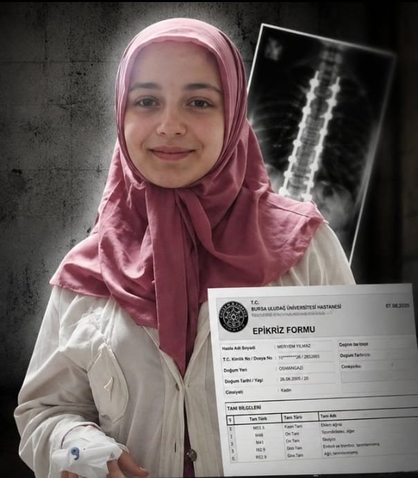 Kadininn_Sesi's tweet photo. 21 yaşındaki Meryem Yılmaz, psikoloji eğitimi alırken özgürlüğünden mahrum kaldı. Yaklaşık bir yıl önce geçirdiği ağır skolyoz ameliyatının ardından omurgasında 22 vida ile yaşamını sürdürüyor. Ailesi, cezaevinde sağlık sorunlarının arttığını belirtiyor.

@GizayDulkadir 
#KadınınSesi