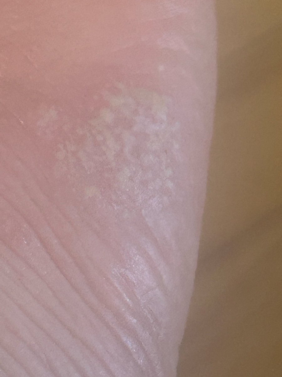 HeroNight72's tweet photo. I may sound dumb for this but what is this on my foot? https://t.co/HzViDUJUwz
