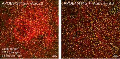 stempharm's tweet photo. 🚨 New publication! 🚨

We're excited to share our latest paper in Cells:
Stimulus-Based ApoE Alzheimer's Disease Induction Model Using Microglia-Containing Brain Organoids for Drug Discovery.

📄 https://t.co/P9Iakcbh0J

🧵👇 https://t.co/DYUT1I0BFy