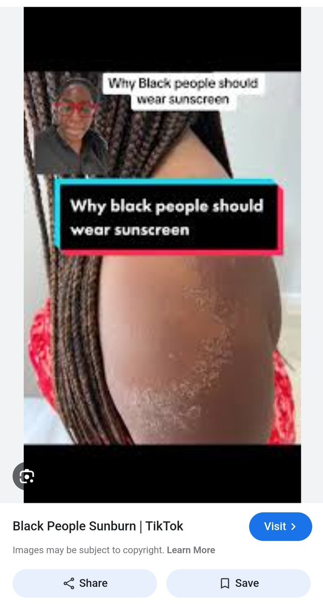 belcalislawyer's tweet photo. @deathxthreats @turntbatch Dont DEHUMANISE blk ppl, you NOT HUMAN if the sun dont burn you! Sunscreen is important for black skin too The last pic is of one of your fellow HOTEPS DRYING n DYING in the egyptian sun lol they DRY DESERT peoples and that man is from the HUMID TROPICS ofc he didn't survive 😭 https://t.co/nS00BQzmuM