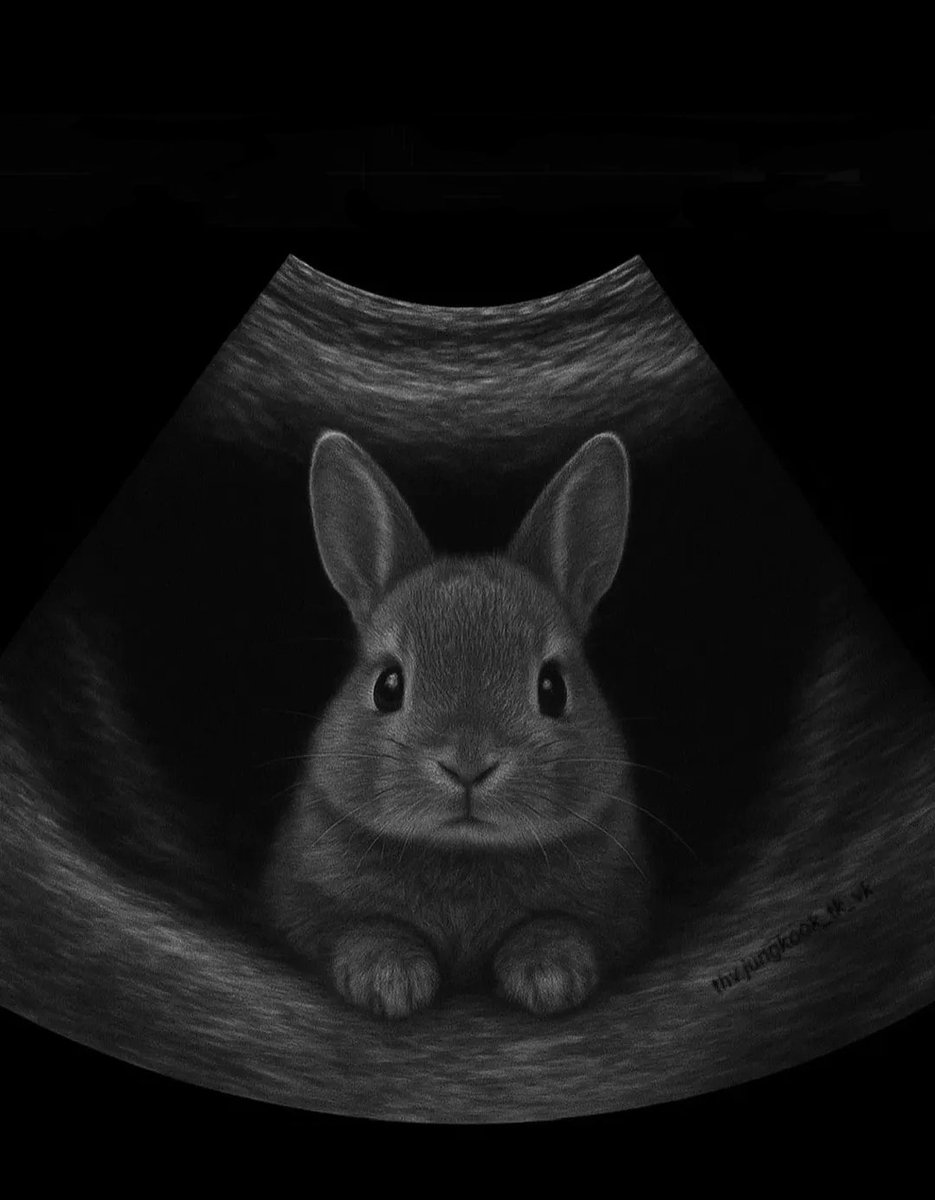 Ko73315's tweet photo. 我が家はうさぎ好きとはいえ、妊娠報告を🐰エコーでやったら、甥っ子姪っ子がめちゃびっくりしてた笑 https://t.co/q0UBIq4Zlu