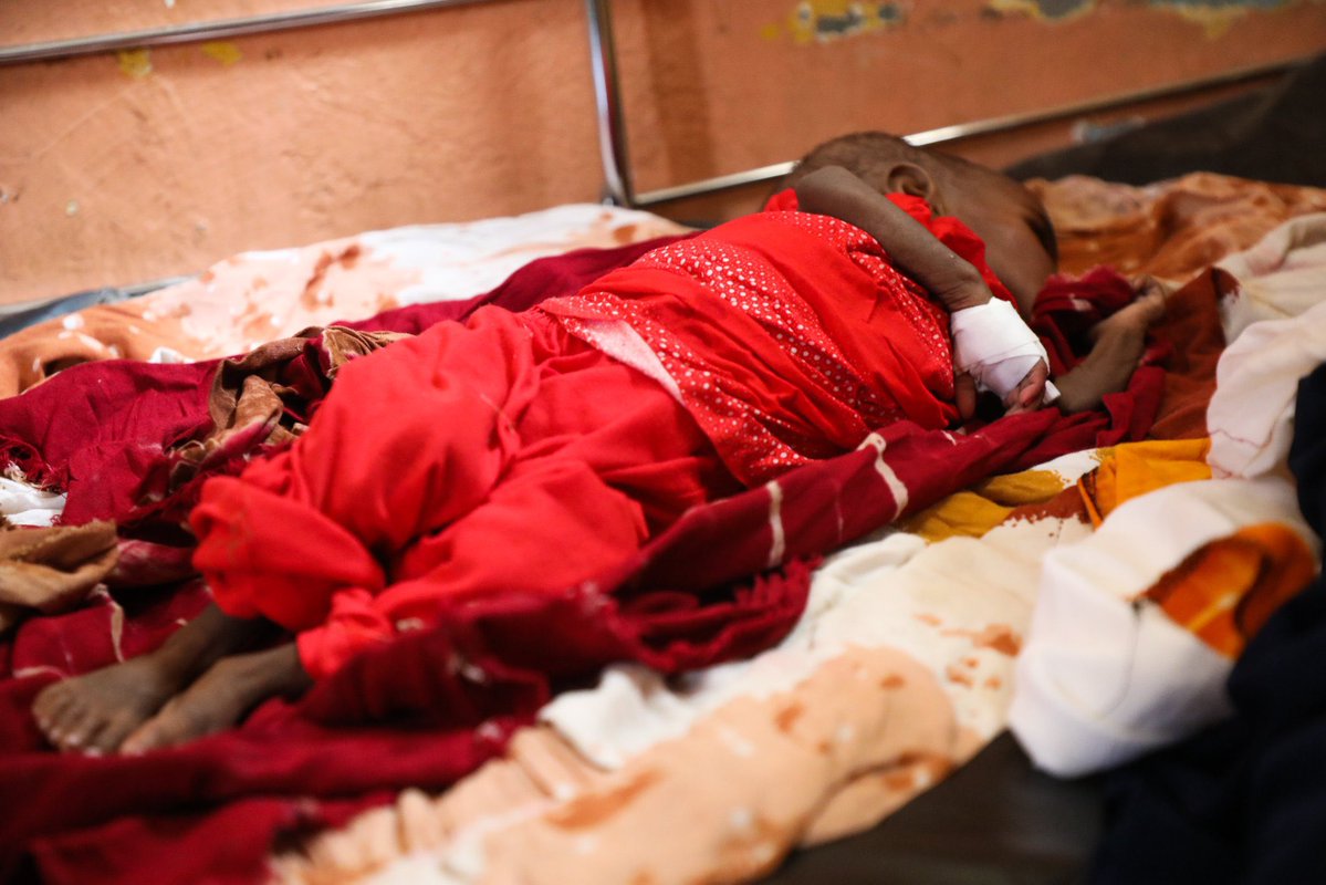 wardirelief's tweet photo. Supported by our #SHFnutrition project, the Stabilization Center &amp; OTP at Hiran Regional Hospital provide lifesaving care to children with acute malnutrition. As the only center of its kind in the region, it serves families from Hiran, Bay, Bakool &amp; Ethiopia. @shf_somalia https://t.co/pPeKWr86gs