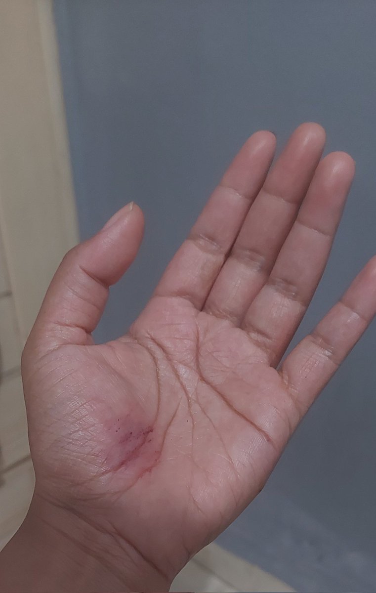 Anyamandaa's tweet photo. Lebih ke sedih gk bisa lari lagi 😭😭😭 https://t.co/qaqPMM4AjS