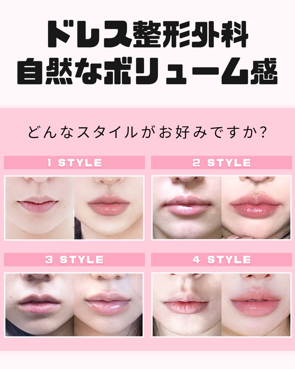 dressjp's tweet photo. 💋唇フィラーをご検討中の方から
よくいただくご質問をまとめました✨

✔️ ダウンタイムはある？
✔️ 麻酔はある？
✔ 不自然にならない？
✔ どれくらい持つの？

お顔全体のバランスやご希望に合わせて
自然な仕上がりをご提案いたします🌷

気になることがあれば
カウンセリング時にご相談ください💕 https://t.co/NcdHsTUpYT