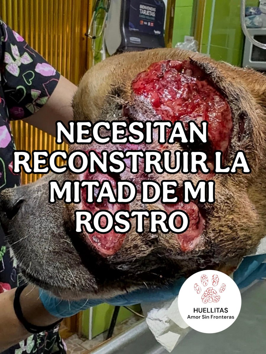 HASF_AnaSDiaz's tweet photo. ⚠️URGE OPERAR A ZEUS⚠️

En solo 11 días Zeus nos ha demostrado que tiene unas inmensas ganas de vivir. ❤️‍🩹

A pesar de todo el dolor que ha sufrido, come muy bien, se deja atender con tranquilidad, tiene fuerza, buen ánimo y una nobleza que nos inspira todos los días.

🩺 ¿Que a pasado con Zeus en estos dias?
✅ Ya se realizaron estudios de sangre, placas y una evaluación.
✅ No presenta metástasis, lo que nos da una verdadera oportunidad de salvarlo.
✅ Ya fue estabilizado, desinfectado y preparado para el siguiente paso.
✅Tiene una anemia que se a estado tratando. Pero el tumor se lo está comiendo.

📋 ¿Cuál es su diagnóstico?
Lo más probable es que el tumor sea TVT, pero solo una biopsia podrá confirmarlo. La biopsia se tomará cuando podamos tener una muestra fresca del tumor, después de la cirugía.

En Huellitas ya hemos logrado salvar casos con TVT, incluso con afectación en la carita.

Lo complicado es que ya perdió un ojitos, presenta sangrado del tumor, está muy bajo de peso y además existe la sospecha de un problema en su bazo, lo que aumenta el riesgo de su tratamiento.

🚨 ¿Qué necesita?
Ya no puede esperar.
Necesitamos reunir $22,000 para realizar su primera cirugía donde se retirara el 1er tumor de la cara y se intenta el del cráneo.

⚠️Cuando se tiene que operar? A más tardar este viernes o sábado, si se junta antes se opera antes. Por que se puede desangrar.

Y se enviará la muestra a biopsia para definir el tratamiento que seguirá.

Después vendrá una segunda cirugía para reconstruir completamente su carita y, dependiendo del resultado, decidir si necesitará quimioterapias y cómo atender el problema del bazo.

🙏 ¿Cómo puedes ayudar?
Cada peso acerca a Zeus a la oportunidad de seguir viviendo.

🏦 BANORTE
072180011828376620
🏦 BANCO Azteca 
4027660028453837
🏦 BBVA
4152314627387643
💙 PayPal: https://t.co/ZRtji14ikC

🎁 También puedes apoyarlo con alimento especial desde nuestra Wish List.

Zeus necesita con urgencia latas Purina Pro Plan o Hill's a/d, disponibles en nuestra lista.

Hoy Zeus tiene posibilidades reales de vivir… pero necesitamos actuar ya. No lo dejemos solo. 🥹🐾

TE RUEGO QUE NO NOS DEJES SOLOS