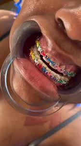JustCasper_2's tweet photo. What is this method called in braces? https://t.co/BaGUikCgUG