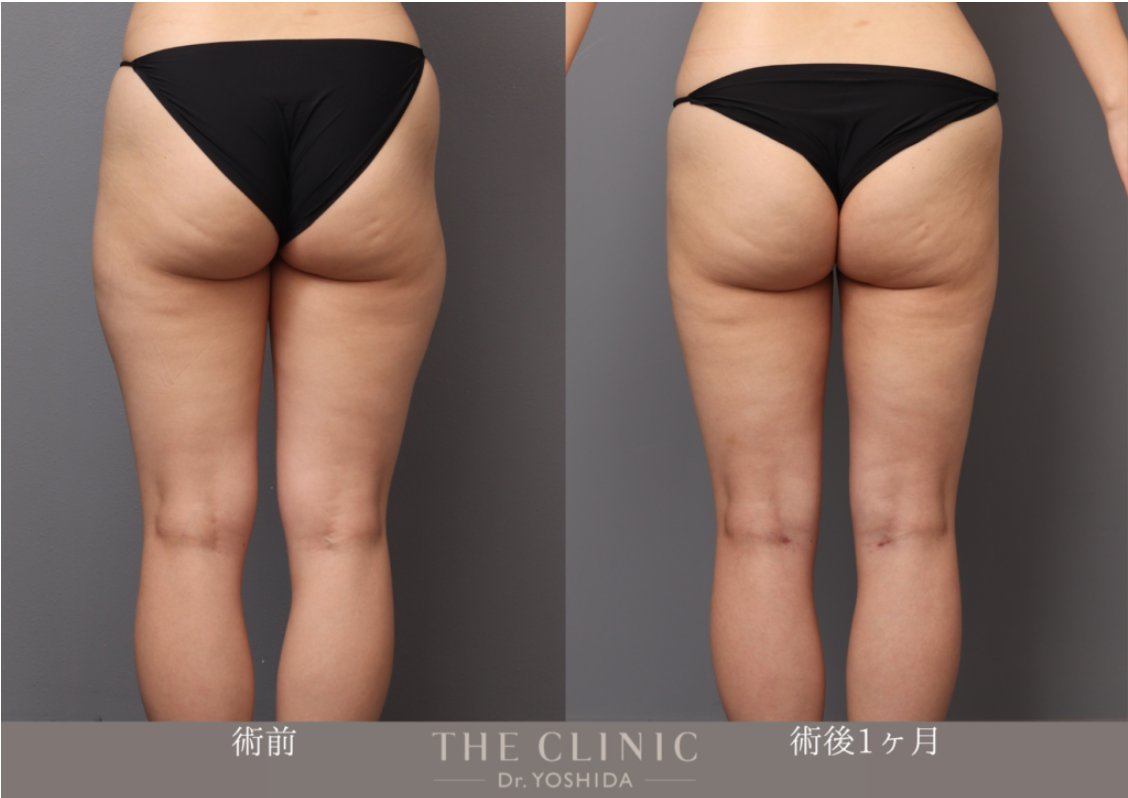 吉田有希 美容外科(JSAPS)専門医|脂肪吸引・豊胸専門_THE CLINIC(ザ・クリニック) tweet media