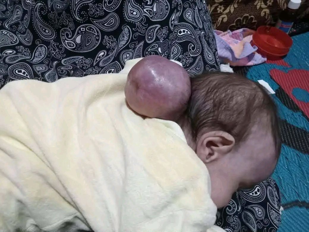 rahijij's tweet photo. الله المستعان من امبارح جمعنا ألف جنيه بس ليوسف والحقنة اليومية بـ1800 ج
لوحده غير العلاج بـ2400ج أضعف الايمان اعملوا ريتويت(الدال على الخير كفاعله) 
وفيه حالة الطفل حذيفه اللي عامل عمليتين في المخ محتاج علاج ب1600 جنيه ولبن متبقي للحالتين 4800ج السهم 50ج من لها 01068837579 https://t.co/L5HDgleHkI