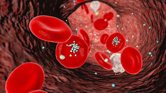 IndiaToday's tweet photo. Patients who suffer heart attack have more micro and nanoplastic in their blood

Read More: https://t.co/llI8uPe78F https://t.co/EUEcVLEUbx