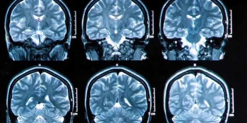 isafernan's tweet photo. El TDAH no es un trastorno. Es una diferencia en la cognición.

Debes aprovecharla, no adormecerla con pastillas. Una vez que lo logres, te permitirá concentrarte intensamente.

Aquí tienes lo que puedes hacer para convertir el TDAH en una superpotencia: 🧵 https://t.co/nkRrMq9pYR