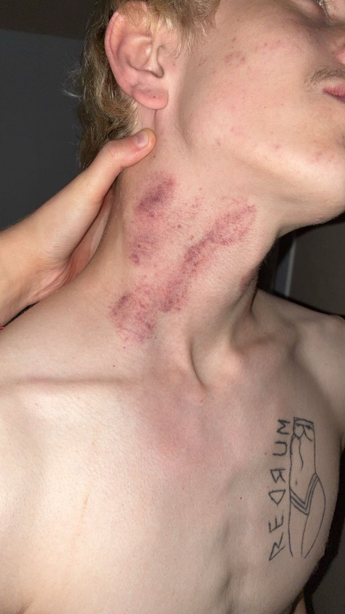 misfitvv's tweet photo. Some pics of my good puppy boy who begged for mommy to mark him up! he says it hurts because i bite so hard yet he still begs like a good little boy to be marked up by mommy. mommys bestest boy. #domfem #nsfw #goodboy #helovesthis
#marks https://t.co/RSmPinfJ1d