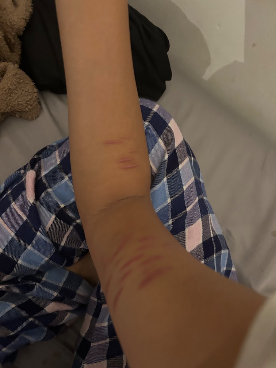 aceofblvdes's tweet photo. full body scar checj bc i miss cuttign https://t.co/7WWgwk8nE3