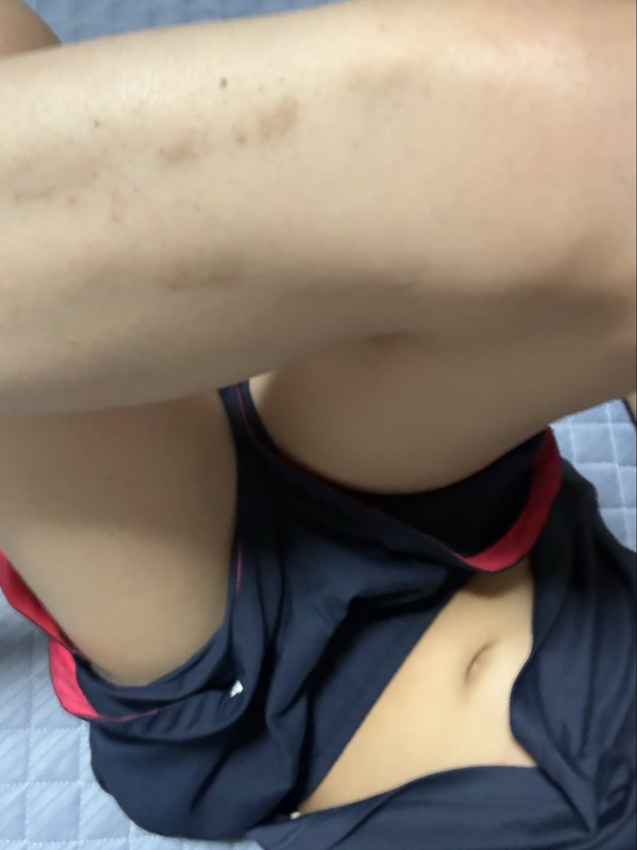 Matsuau's tweet photo. 初めて足の毛除毛したけど結構スッキリ https://t.co/ZqHYi0ySLT