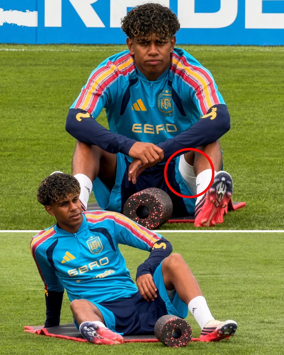 ofootball__'s tweet photo. 🚨 LAMINE INJURED?

Alarm bells are ringing in Spain; Lamine did not take part in today's national team training session. https://t.co/EmtI3MVr2E