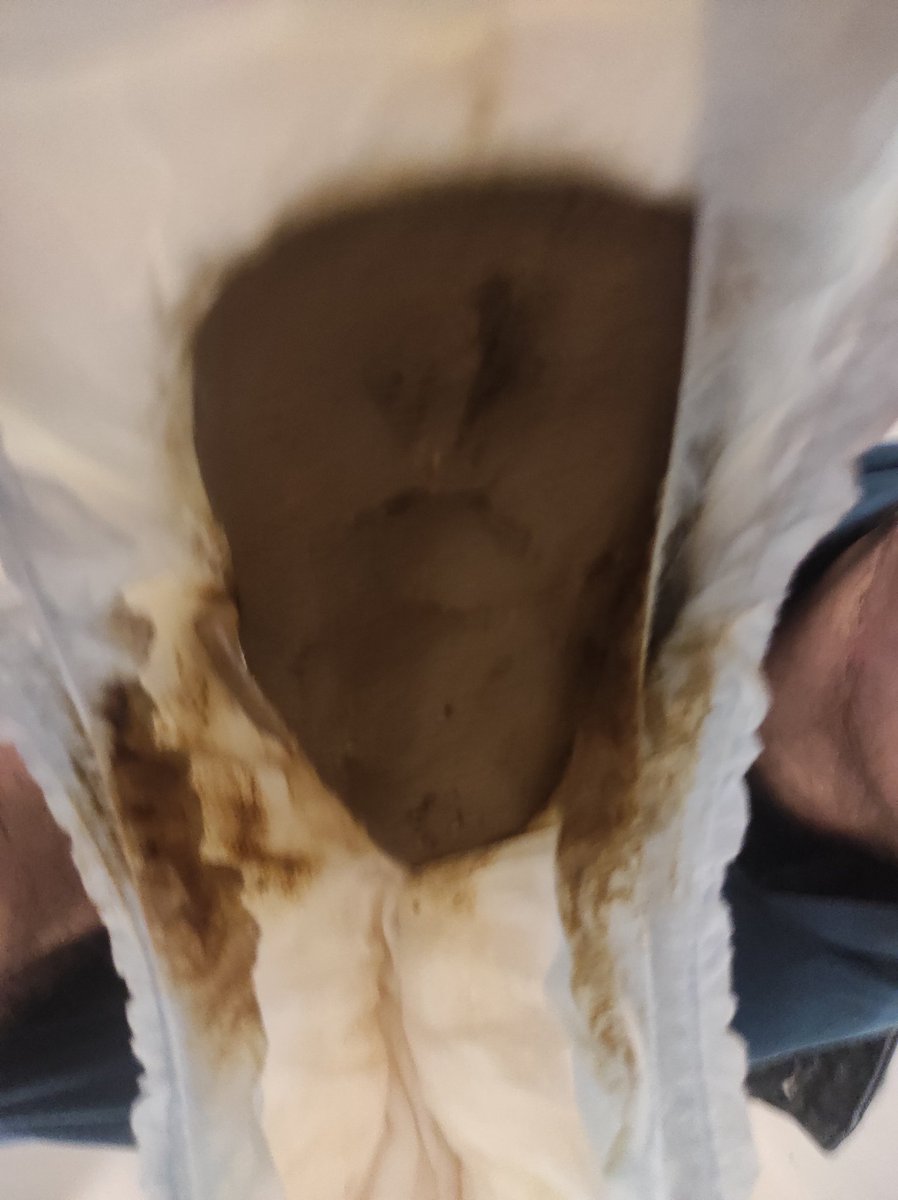 CristianPooping's tweet photo. Ops.. 😒😒😮‍💨😮‍💨 https://t.co/MaGRmi0gVu