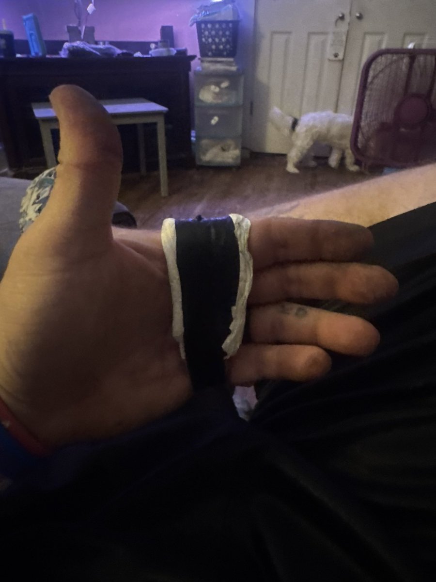 ShakeyMorris's tweet photo. Cut a chunk of hand off with needle nose pliers…yes it’s possible https://t.co/ESiPTYc6ve