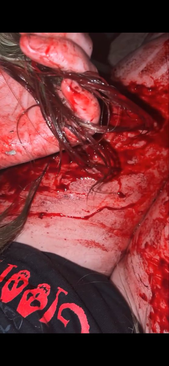 toyboxxed's tweet photo. be nice ab my big ass thighs, i’m working on it, but wanted to show the damage and healed :p 
tw: sh
it’s def all fake tho. sfx ofc https://t.co/HgJWA0WxdU
