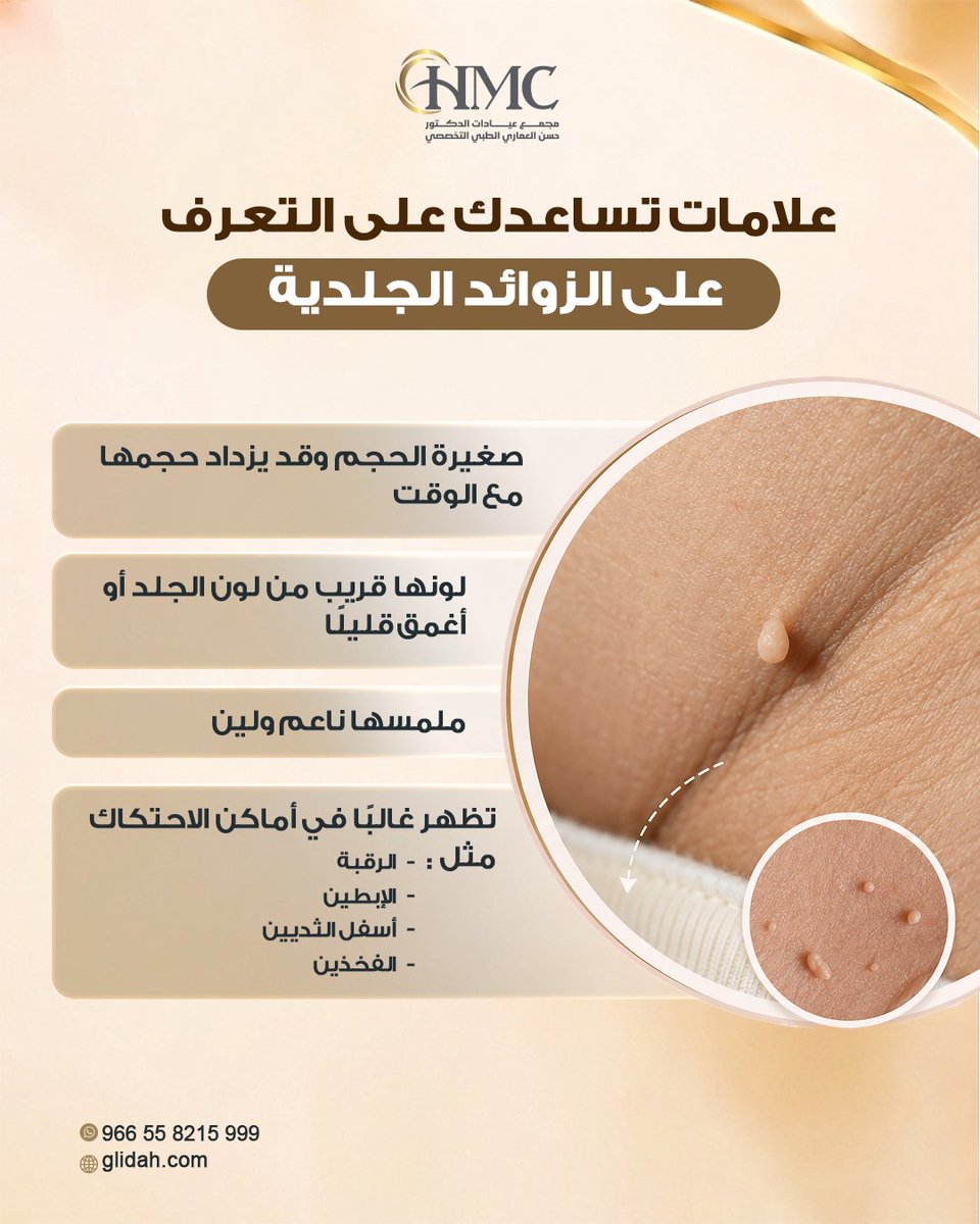 halammari1392's tweet photo. علامات تساعدك على التعرف على الزوائد الجلدية 

-  صغيرة الحجم وقد يزداد حجمها مع الوقت. 

- لونها قريب من لون الجلد أو أغمق قليلًا. 

- ملمسها ناعم ولين. 

- تظهر غالبًا في أماكن الاحتكاك مثل:

🔸الرقبة

🔸الإبطين

🔸أسفل الثديين

🔸الفخذين

#زوائد_جلدية
#مشكلات_جلدية https://t.co/8E0tp9CaiV