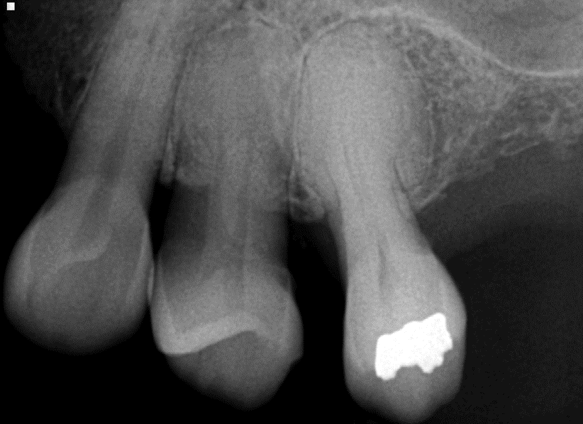 dentometric's tweet photo. Diferentes Radiopacidades en los Maxilares

Enlace: https://t.co/AIvzO3A79b https://t.co/k6uuJrE4ci