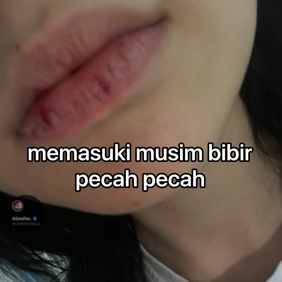 OHMYV3NUS's tweet photo. fr https://t.co/YfZwX8vxAE