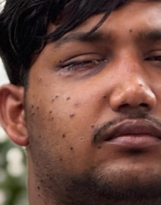KanojiaPJ's tweet photo. Dictator Narendra Modi using pellet guns on the students. This is cruelty of highest order. 

I want Modi to live long and suffer in jail. He should not be spared! https://t.co/Uoqhj9klfT