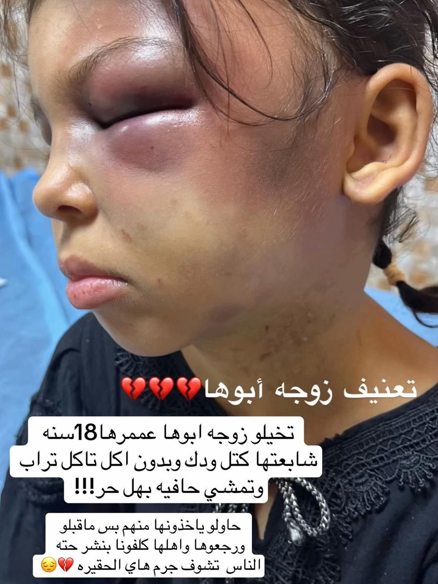 y137rw's tweet photo. جريمة تعنيف توقظ الضمائر وتهتز لها الابدان

صرخة مظلومة في وجه القسوة 
ماذن هاذه الطفله ان تعاني كل هاذا الظلم

اعطوني رأيكم في زوجة الاب. وهل ما تفعله يجب السكوت عنه https://t.co/VOBqUvCOmM
