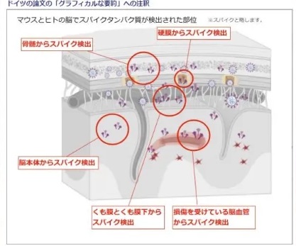 tsiwakawa's tweet photo. @koumonka_doctor ＞スパイクタンパクは脳血液関門を破壊して脳に入る
真に危険な“ワクチン”ですね。
（ホントは、ワクチンではなくmRNA型遺伝子製剤） https://t.co/C7JVwlG9P4