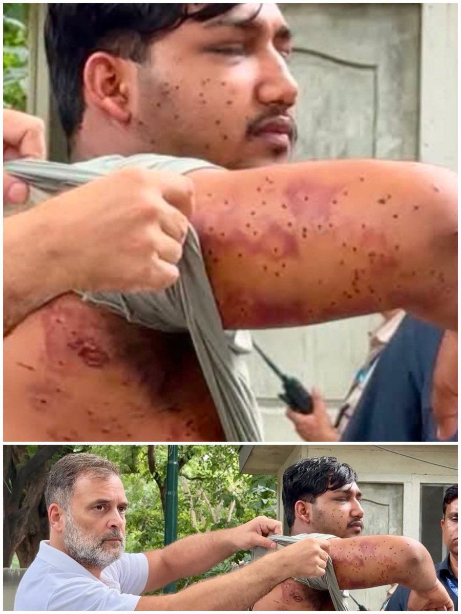 Imsrikanth_03's tweet photo. Devastated our democracy,, 😔 
What nonsense beating like this

Must &amp; should resign our Education minister Devendra pradan.

All india support with students,,🇮🇳
#GenZWithBharat https://t.co/PFA0OklnUh