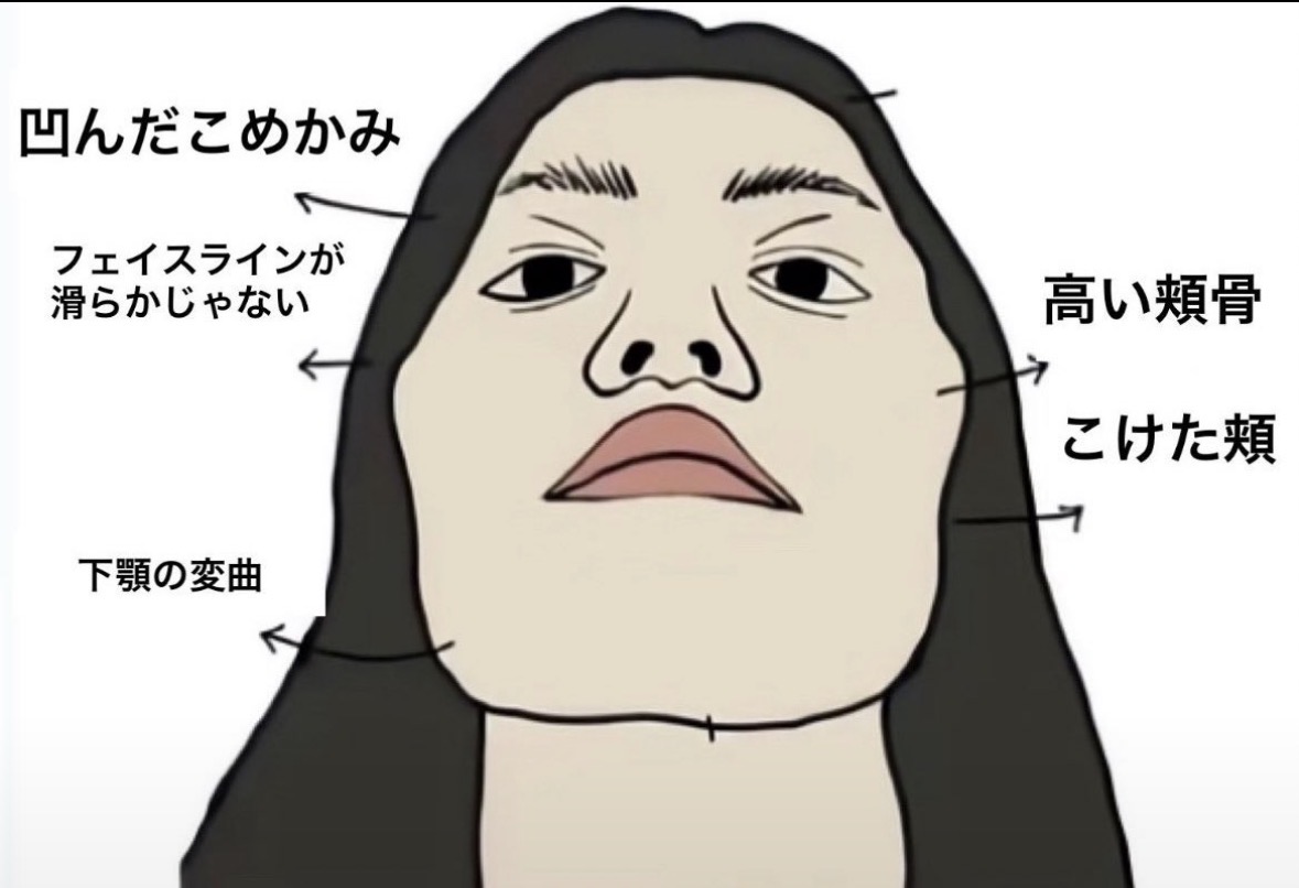 ko_gankotan's tweet photo. 顔がデコボコしてる女子、もしかしたらそれ治るかも！！！骨じゃなくてなかには、筋肉のこわばりの人もいるから一旦これやってみて‼️ https://t.co/B0GkZ4gPoE