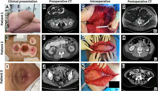 TransplantDirect tweet media